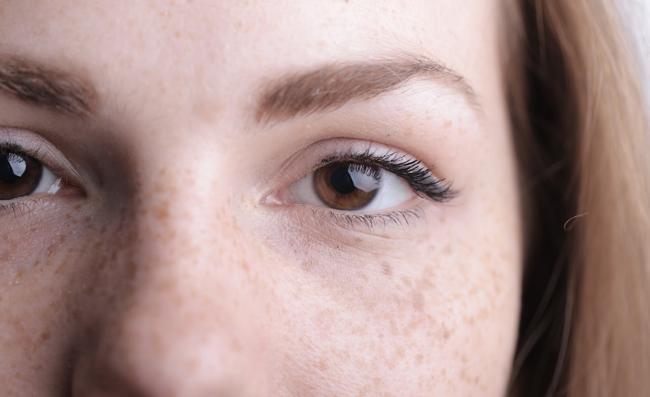 Dark Spots Removal Cream: What Actually Works and How to Treat Pigmentation Properly